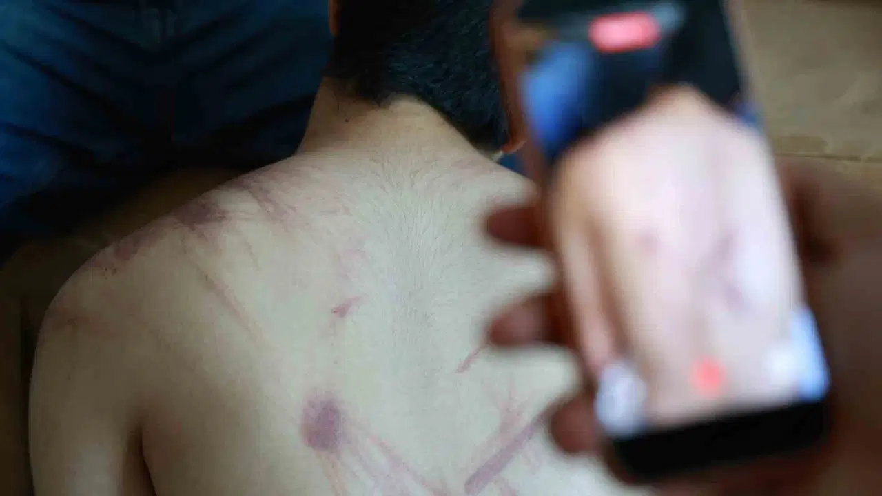 Elazigda rehabilitasyon merkezinde siddet iddiasi adli ve idari sorusturma baslatildi AIxrfWnv